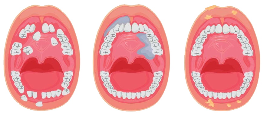 Best Dentist in Thiruvanmiyur