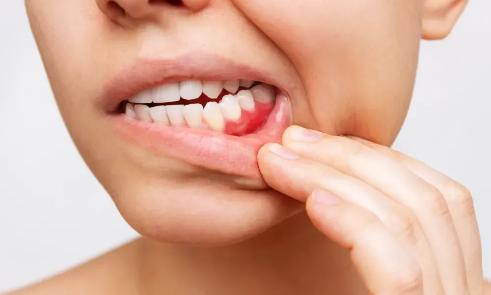 Oral Cancer Doctor in Chennai