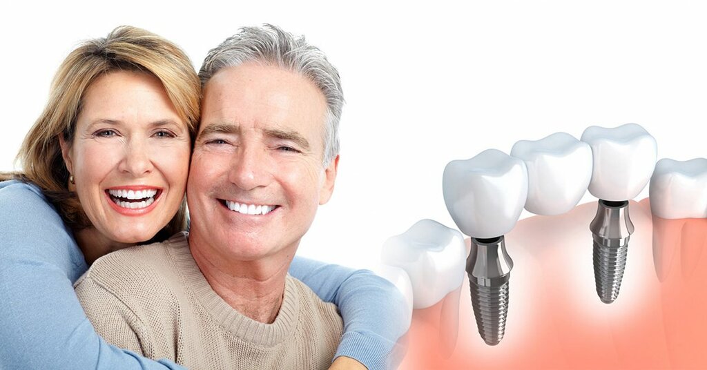 Dental Implants Treatment in Chennai